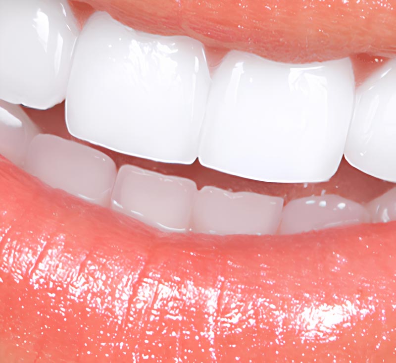teeth_after teeth_after